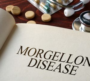 sindrome di Morgellons