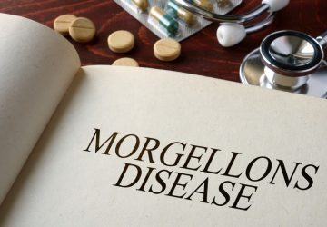 sindrome di Morgellons