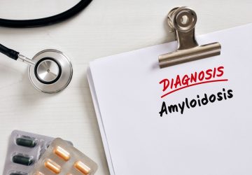 foglio con la scritta Dignosis Amyloidosis, Amiloidosi