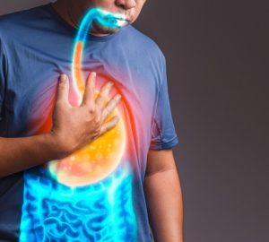 immagine computerizzata di reflusso gastroesofageo nel corpo di un uomo