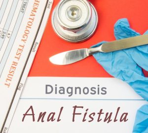 fistola anale, guanti, bisturi e scritta diagnosis anal fistula