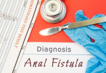 fistola anale, guanti, bisturi e scritta diagnosis anal fistula