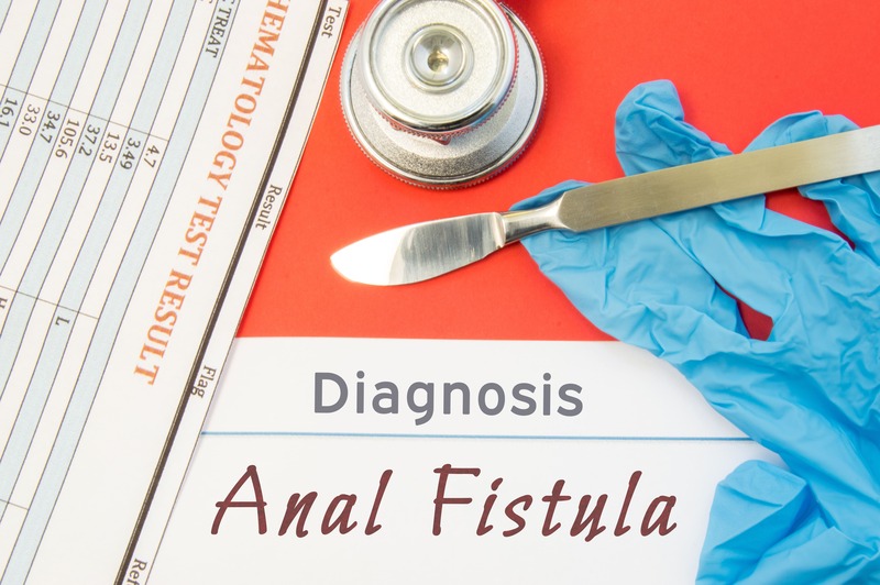 fistola anale, guanti, bisturi e scritta diagnosis anal fistula