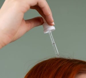 La dermatite seborroica può colpire viso, cuoio capelluto e corpo: Primo piano di una mano che applica siero per capelli su…