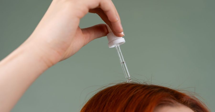 La dermatite seborroica può colpire viso, cuoio capelluto e corpo: Primo piano di una mano che applica siero per capelli su…