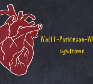 Sindrome di Wolff-Parkinson-White