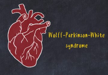 Sindrome di Wolff-Parkinson-White
