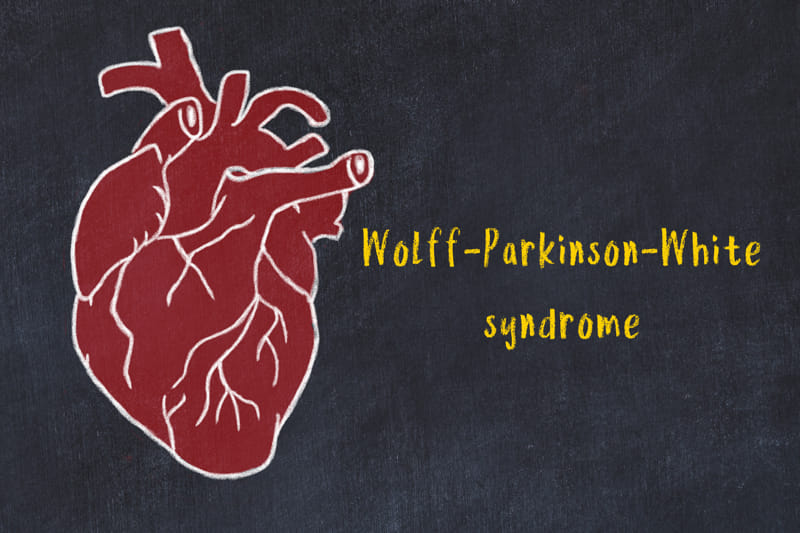 Sindrome di Wolff-Parkinson-White